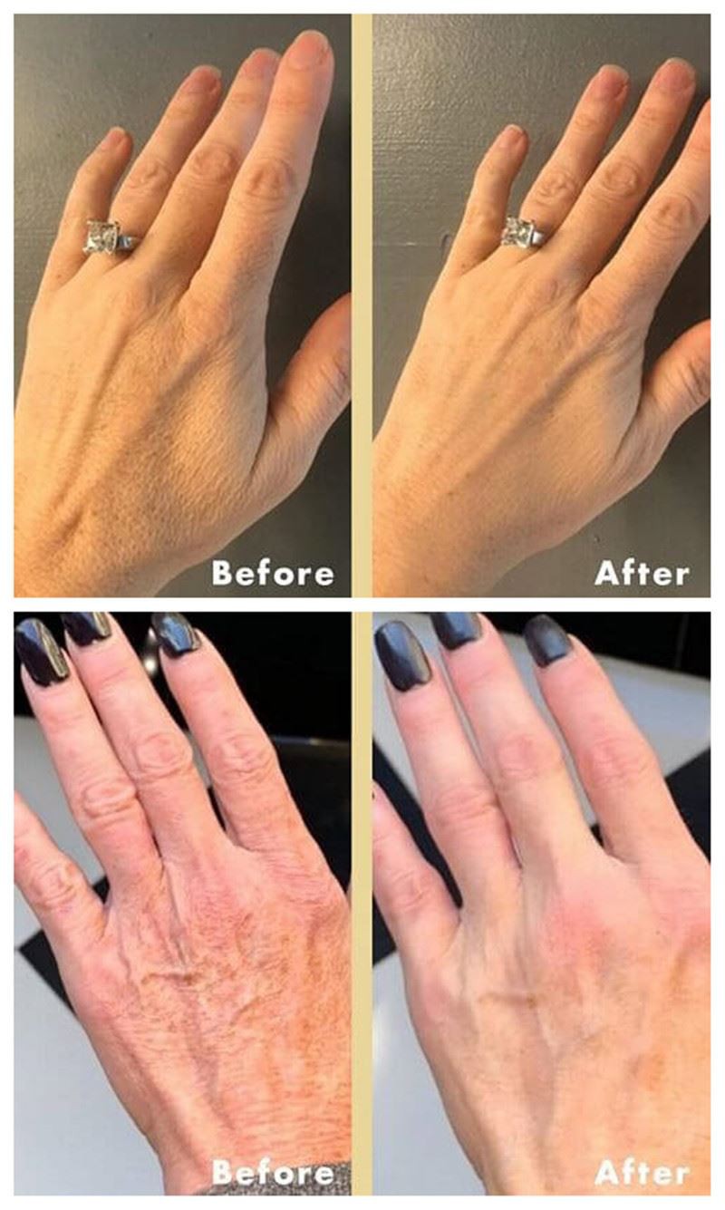 Customer feedback Customer feedback