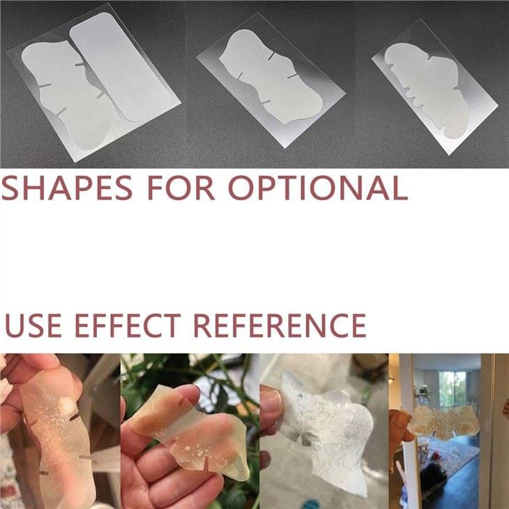 hydrocolloid patches for nose