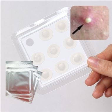 بقع بقعة حب الشباب